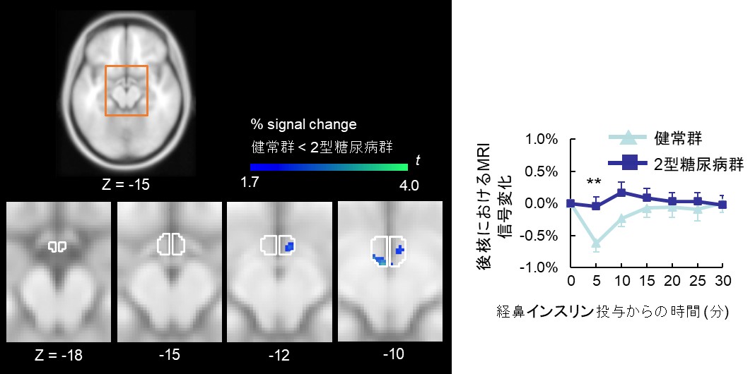 20260609プレスリリース画像_1