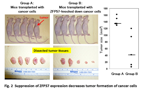 Fog.2 Suppression of ZFP57 expression decreases tumor formation of cancer cells