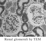 Renal glomeruli by TEM