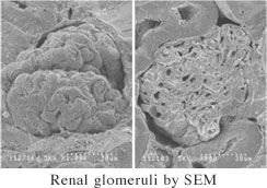 Renal glomeruli by SEM