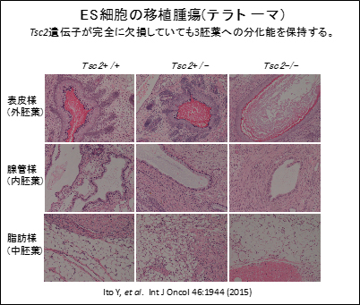 ES細胞の移植腫瘍(テラトーマ)