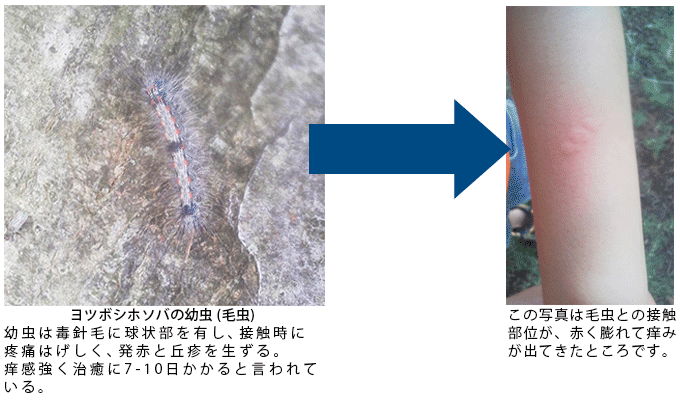 環境医学研究所 なぜ かゆい かゆみと真剣勝負 かゆみの克服を目指して 順天堂大学大学院医学研究科