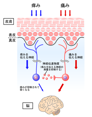 お 風呂 に 入る と 痒く なる