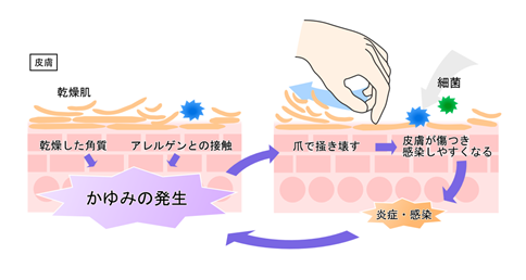 血行 が 良く なると 痒く なる