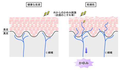 環境医学研究所 なぜ かゆい かゆみと真剣勝負 かゆみの克服を目指して 順天堂大学大学院医学研究科