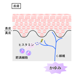 内臓 乾癬 原因