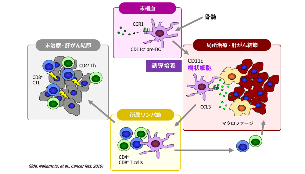 肝がん局所治療と樹状細胞による免疫賦活作用